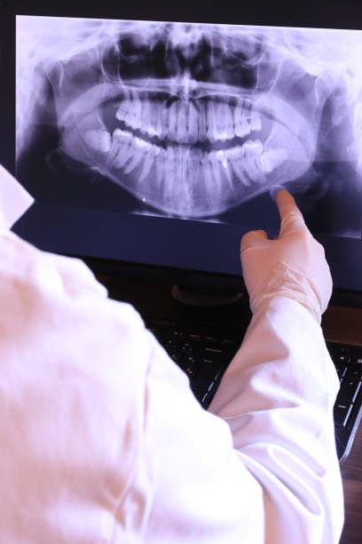 Best Emergency Tooth Extraction in Weldon, NC