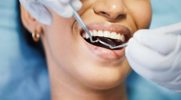 Best Emergency Wisdom Teeth Removal in Weldon, NC